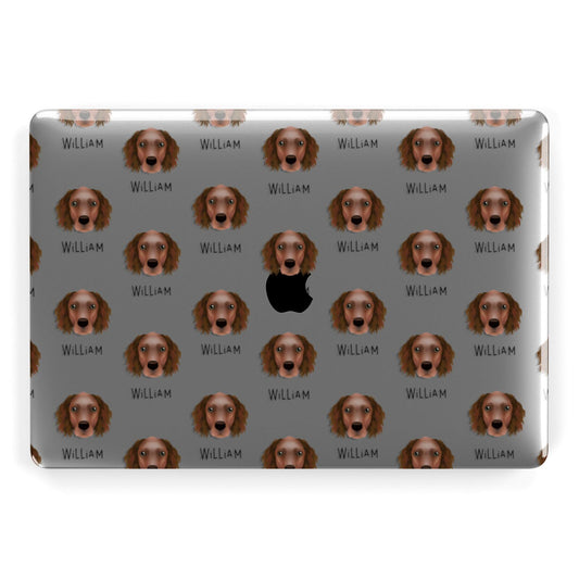 Sprocker Icon with Name Apple MacBook Case
