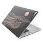 Abstract Sunset Apple MacBook Case Side View