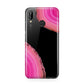 Agate Bright Pink Huawei P20 Lite Phone Case