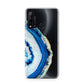 Agate Dark Blue and Turquoise Huawei P20 Lite 5G Phone Case