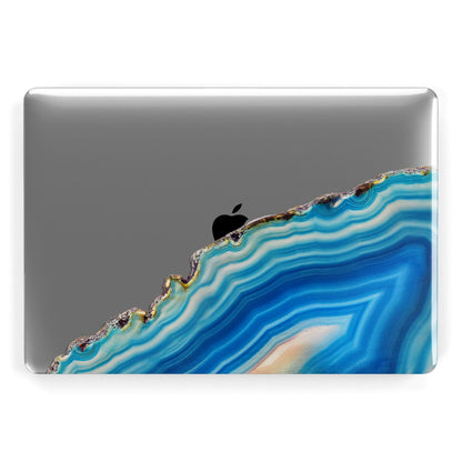 Agate Pale Blue and Bright Blue Apple MacBook Case