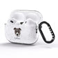 American Pit Bull Terrier Personalised AirPods Pro Glitter Case Side Image