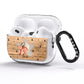 Baby Photo Upload AirPods Pro Glitter Case Side Image