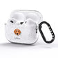 Bassador Personalised AirPods Pro Glitter Case Side Image