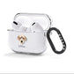 Bedlington Whippet Personalised AirPods Clear Case 3rd Gen Side Image