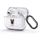 Belgian Malinois Personalised AirPods Glitter Case 3rd Gen Side Image