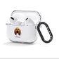 Bloodhound Personalised AirPods Clear Case 3rd Gen Side Image