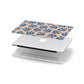 Blue Coral Apple MacBook Case in Detail