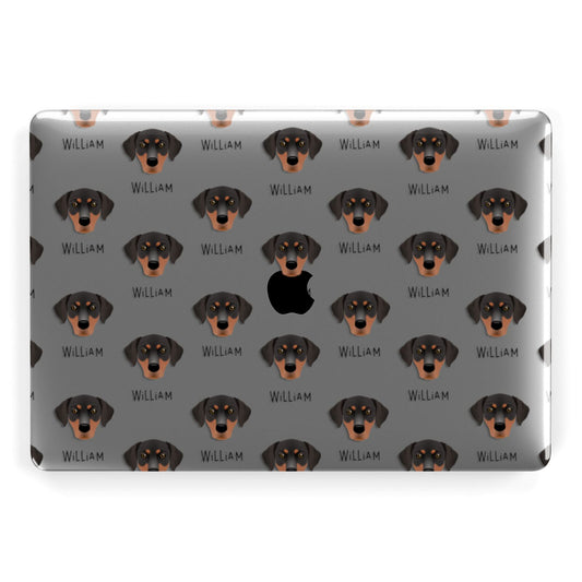 Blue Lacy Icon with Name Apple MacBook Case