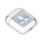 Blue Onyx Marble AirPods Case Laid Flat