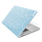 Blue Snakeskin Apple MacBook Case Side View