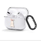 Bunny AirPods Clear Case 3rd Gen Side Image