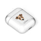 Chi Staffy Bull Personalised AirPods Case Laid Flat