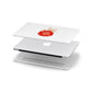 Christmas Bauble Personalised Apple MacBook Case in Detail