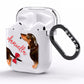 Custom Dachshund AirPods Clear Case Side Image