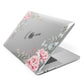 Custom Decorative Floral Apple MacBook Case Side View