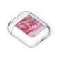 Custom Pink Marble AirPods Case Laid Flat