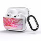 Custom Pink Marble AirPods Pro Clear Case Side Image