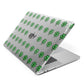 Custom Shamrocks Apple MacBook Case Side View