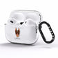 Dobermann Personalised AirPods Pro Clear Case Side Image