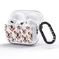 Dog Photo Face AirPods Pro Glitter Case Side Image