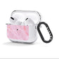 Dreamy Pink Marble AirPods Clear Case 3rd Gen Side Image