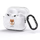 Finnish Lapphund Personalised AirPods Pro Glitter Case Side Image