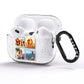 Four Square Photo Tiles AirPods Pro Glitter Case Side Image