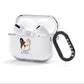 French Bulldog Personalised AirPods Clear Case 3rd Gen Side Image