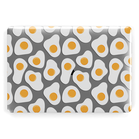 Fried Egg Apple MacBook Case