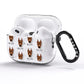 German Pinscher Icon with Name AirPods Pro Glitter Case Side Image