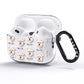 Glen Of Imaal Terrier Icon with Name AirPods Pro Glitter Case Side Image