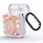Gold And White Marble AirPods Clear Case Side Image