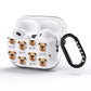 Griffon Bruxellois Icon with Name AirPods Pro Glitter Case Side Image