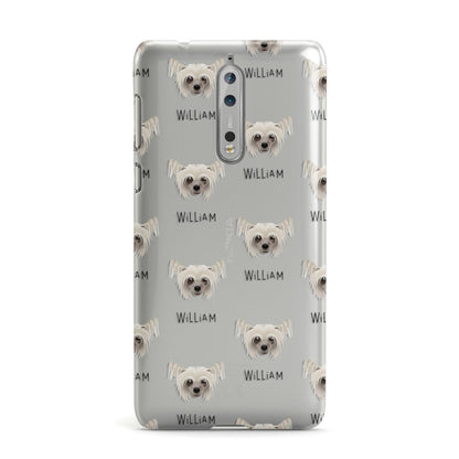 Hairless Chinese Crested Icon with Name Nokia Case