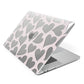 Heart Apple MacBook Case Side View