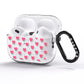 Heart Patterned AirPods Pro Glitter Case Side Image