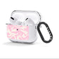 Hippy Swirl AirPods Clear Case 3rd Gen Side Image