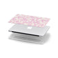 Hippy Swirl Apple MacBook Case in Detail