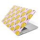 Hot Air Balloon Apple MacBook Case Side View