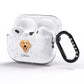 Hovawart Personalised AirPods Pro Glitter Case Side Image