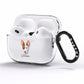 Ibizan Hound Personalised AirPods Pro Clear Case Side Image