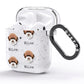 Lagotto Romagnolo Icon with Name AirPods Glitter Case Side Image