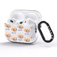 Malti Poo Icon with Name AirPods Pro Glitter Case Side Image