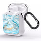 Marble AirPods Clear Case Side Image