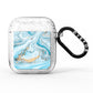 Marble AirPods Glitter Case