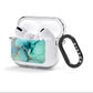 Marble Pattern AirPods Clear Case 3rd Gen Side Image