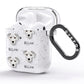 Miniature Schnoxie Icon with Name AirPods Glitter Case Side Image