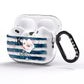 Monogram Pink Blue Striped Watercolour AirPods Pro Glitter Case Side Image