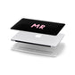 Mr Apple MacBook Case in Detail